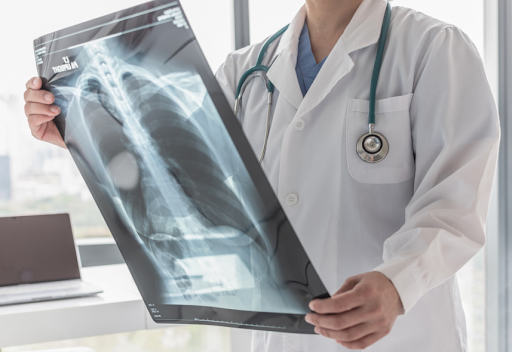 Doctor holding a chest X-ray, highlighting the importance of early detection and prevention for respiratory health.