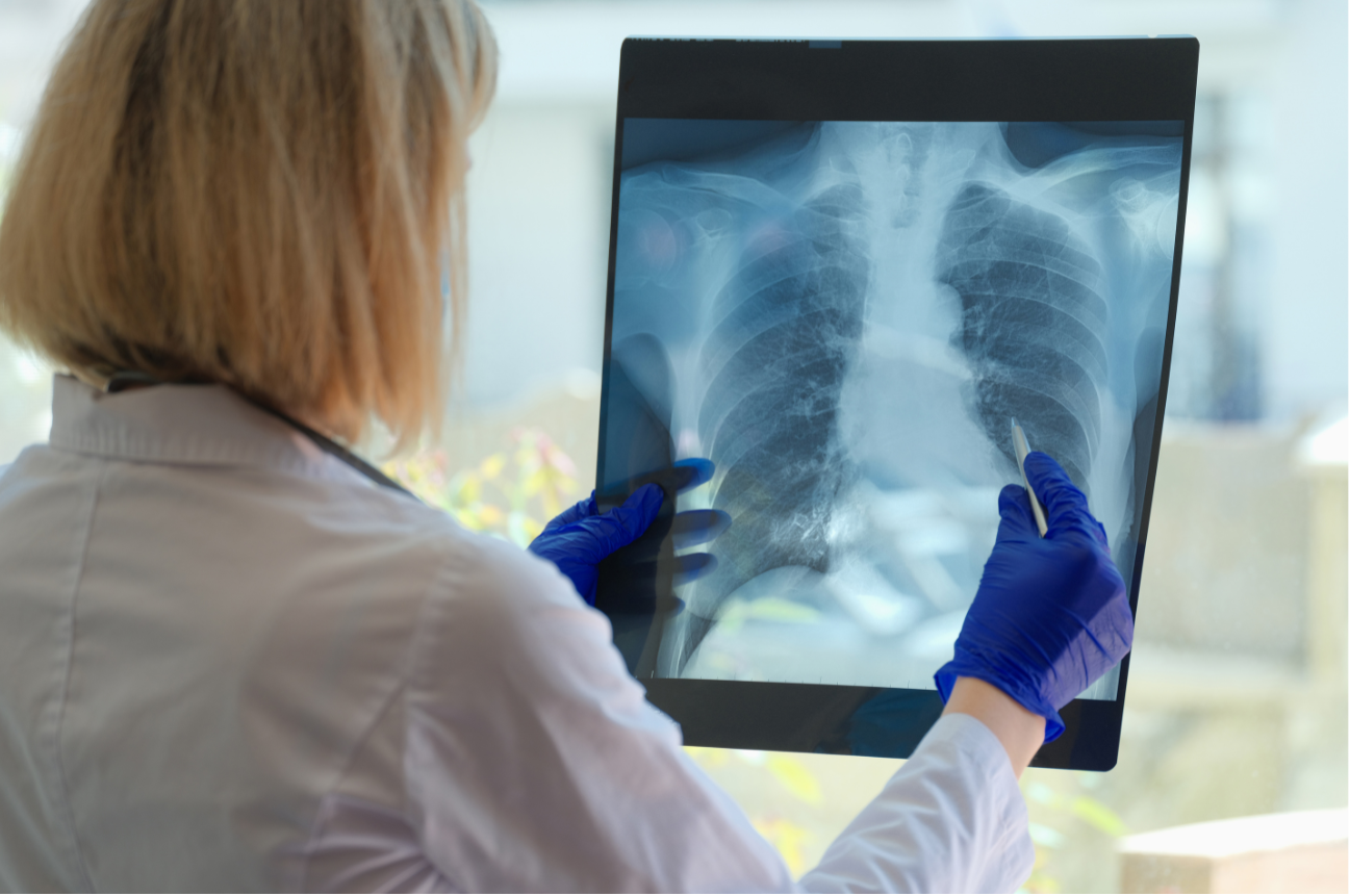 Doctor holding an X-ray of a patient’s chest, analyzing for signs of COPD.