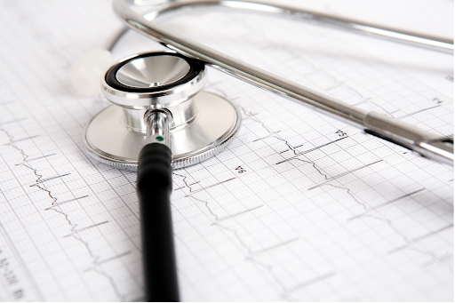 Stethoscope resting on an ECG chart, symbolizing diagnostic approaches for COPD.